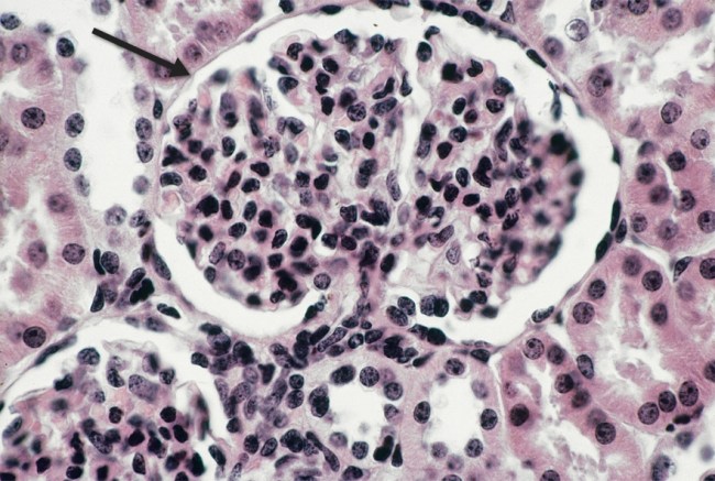 Glomerulus in the kidney. Image