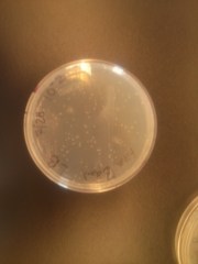 plate showing colonies growing